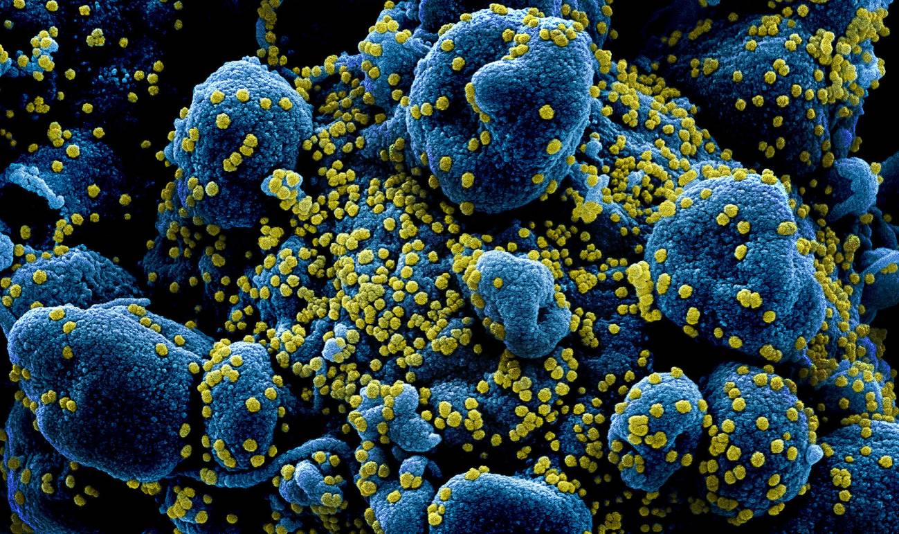 Los virus que pueden permanecer escondidos en el cuerpo y causar problemas décadas después (y qué pasa con el coronavirus)