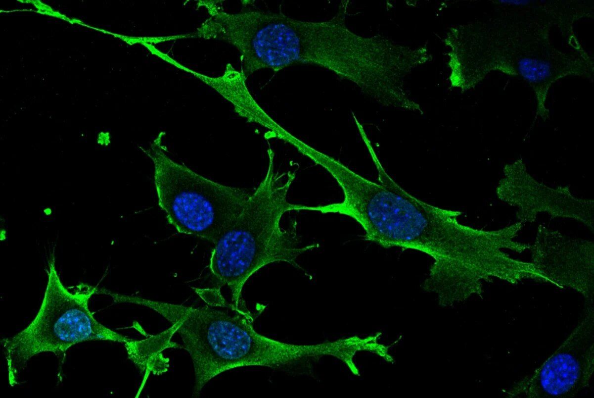 Identifican gen que provoca la aparición del cáncer