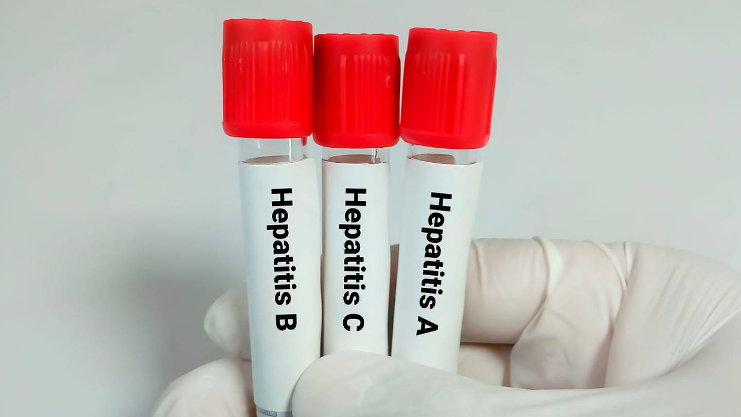 Hepatitis A, B, C, D, E y la infantil: ¿Cómo se contagian?