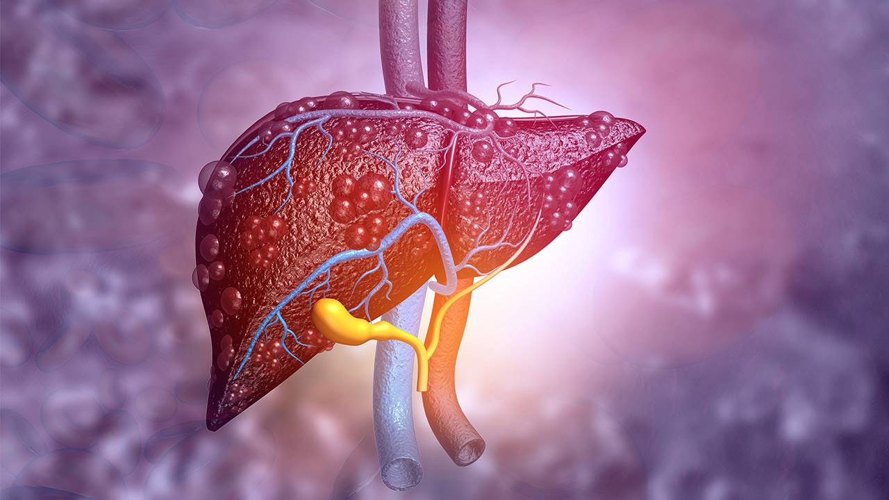 ¿Qué es la hepatitis? Síntomas, tratamiento y riesgos