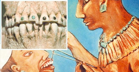 Estudio revela por qué los mayas se incrustaban piedras preciosas en los dientes