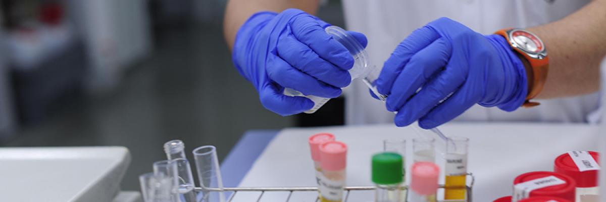 Científicos identifican nuevo biomarcador para el lupus
