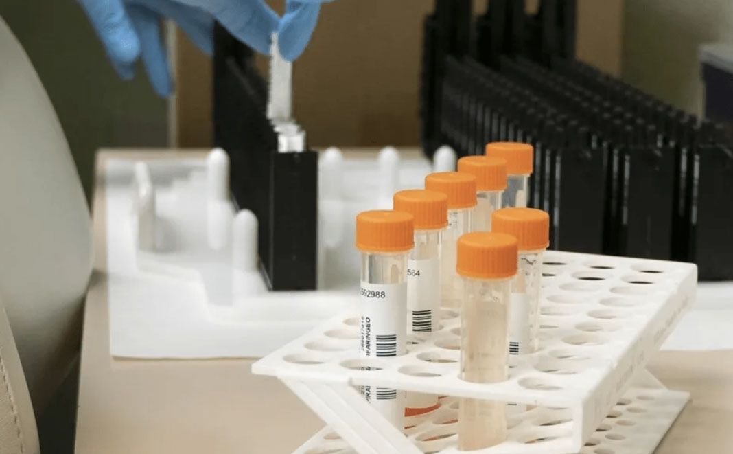 Viruela del mono no tardará mucho en declararse pandemia: experto