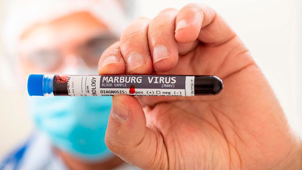 Virus de Marburgo: sin vacuna y con hasta 88% de letalidad; esto es lo que hay que saber