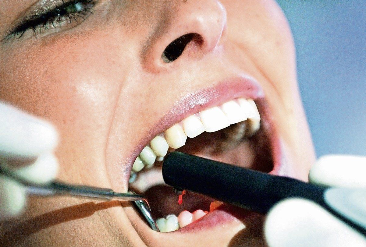 Mitos y realidades sobre las caries, ¿Cómo mantener una buena higiene bucal?