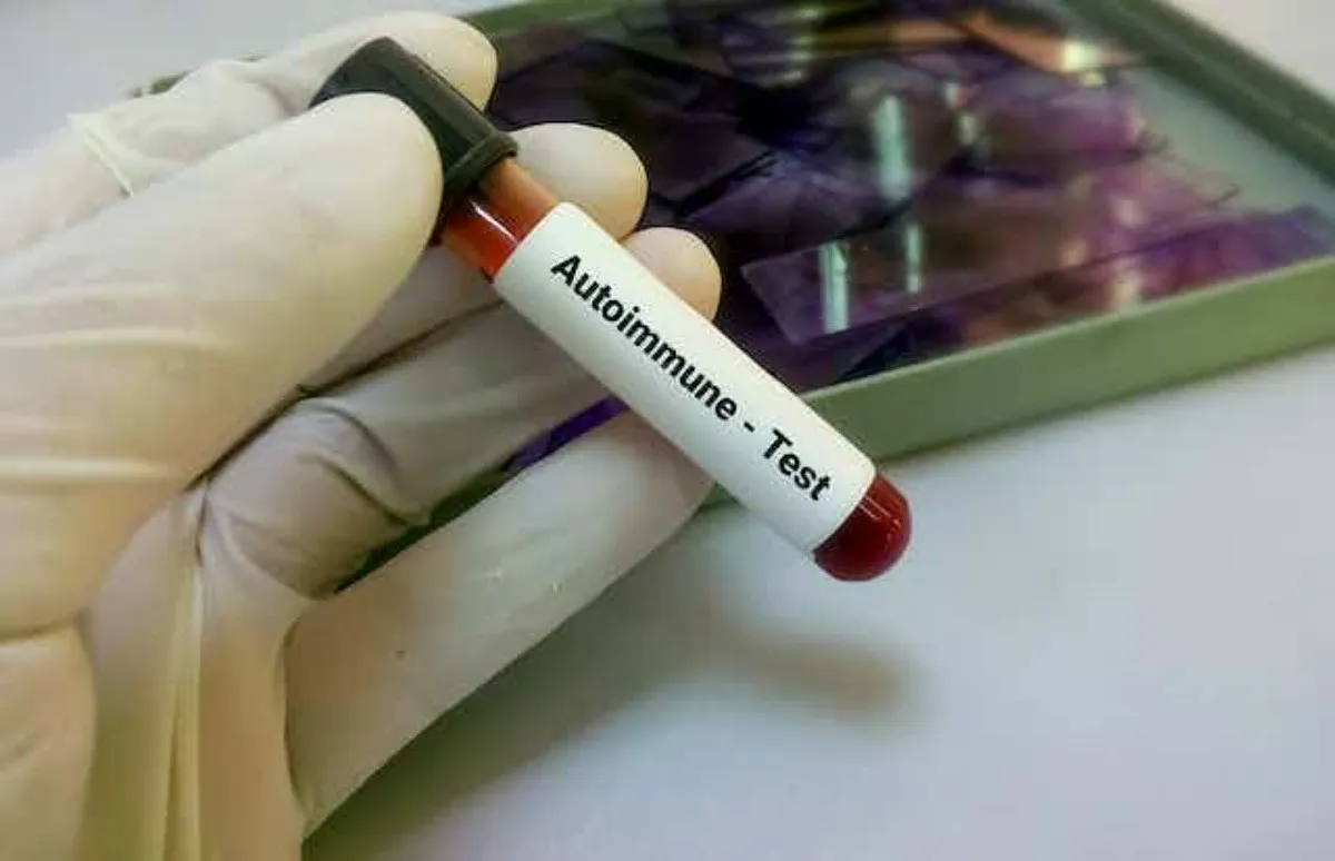 Enfermedades autoinmunes: cuando el enemigo es uno mismo￼