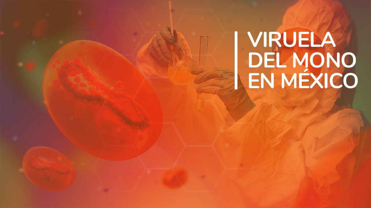 ¿Cuáles son los estados de la República que presentan casos de viruela del mono? Ya suman 147 contagios en México