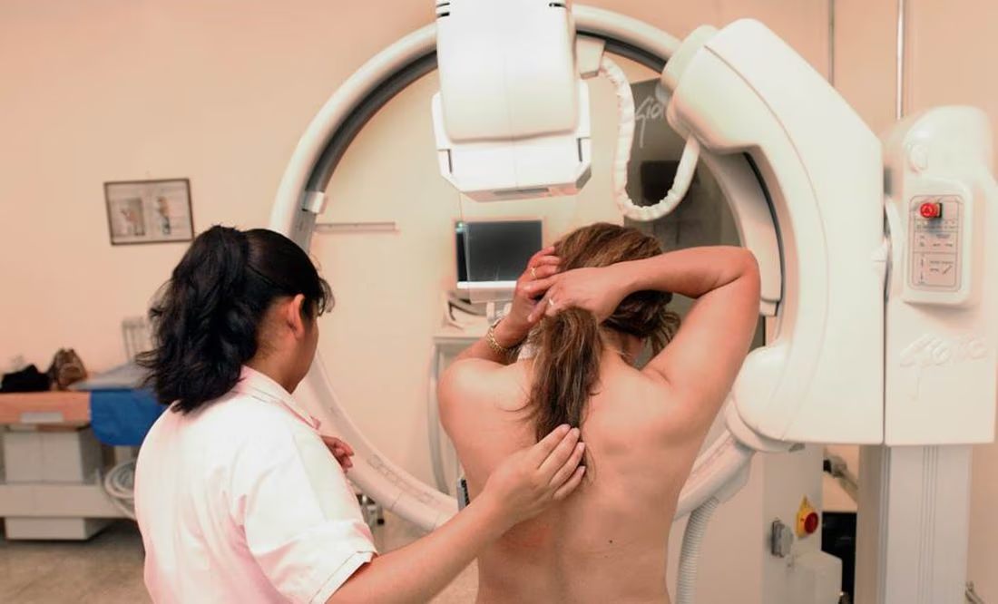 Inteligencia Artificial podría ayudar a detectar el cáncer de mama
