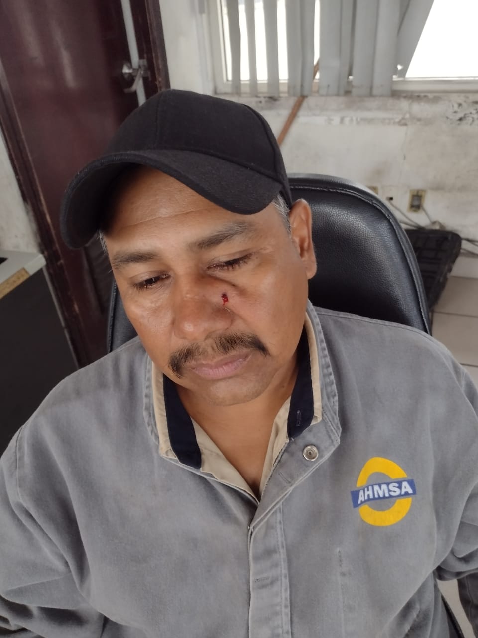 Le disparan en rostro a guardia de AHMSA