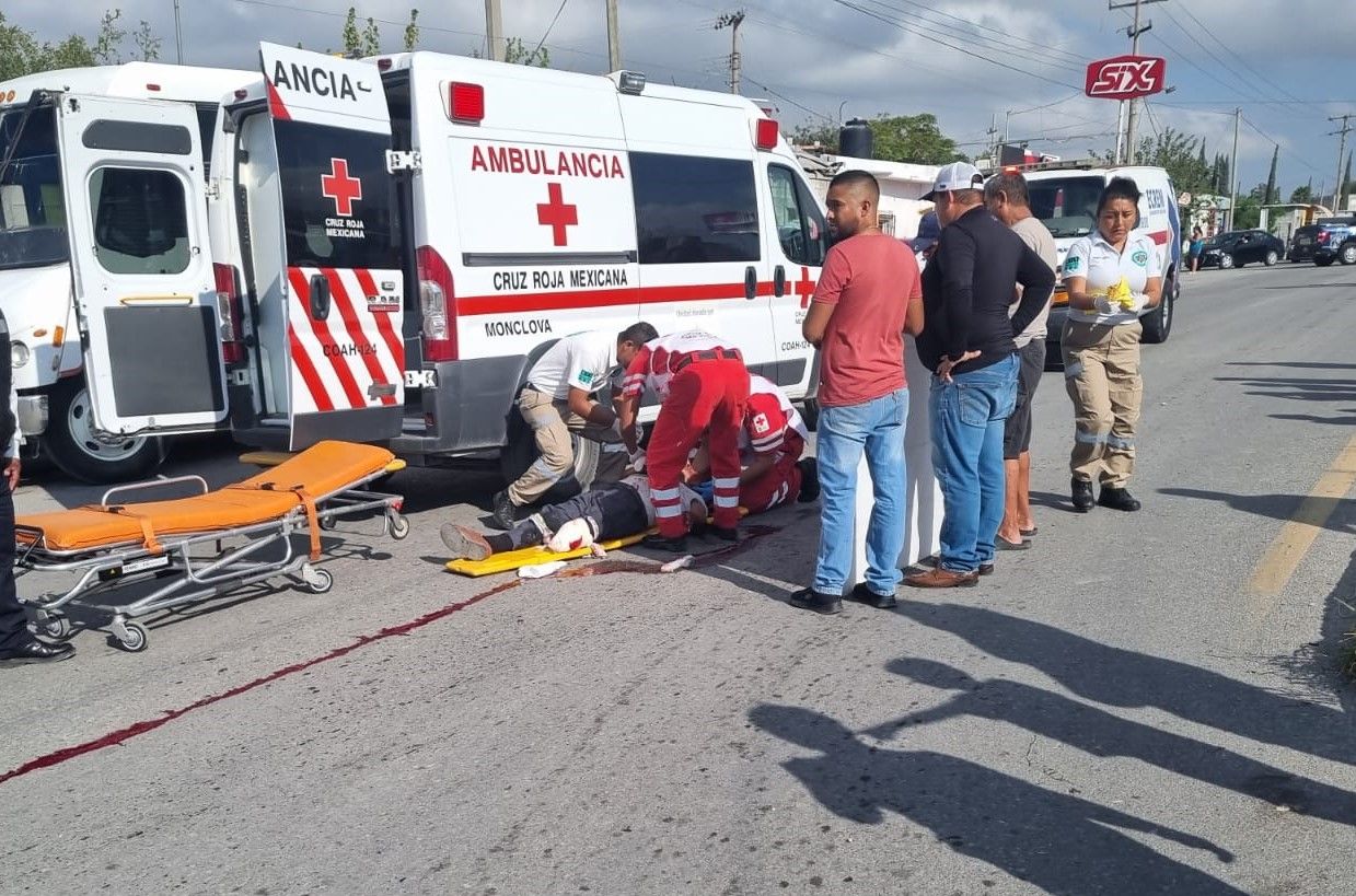 Muere septuagenario atropellado por torton
