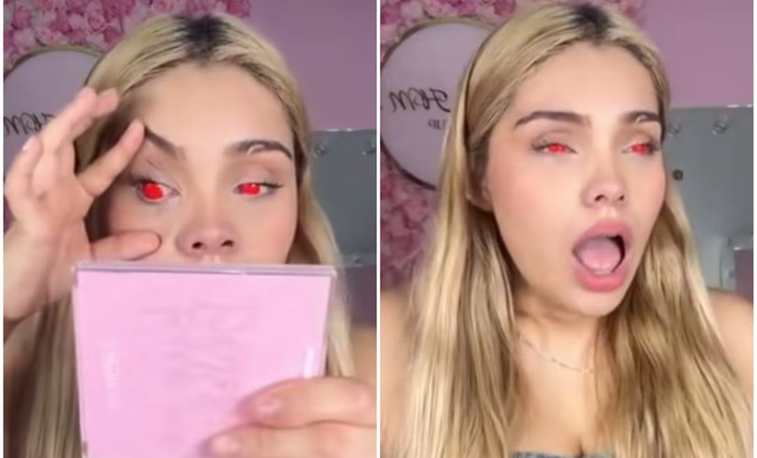 «Ángel, llévame al seguro»: Influencer pide ayuda por pupilentes que le provocaron “perder la visión”