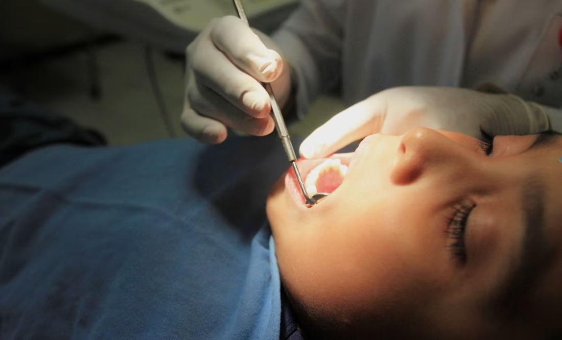 Qué es la halitosis, enfermedad que produce el mal aliento excesivo