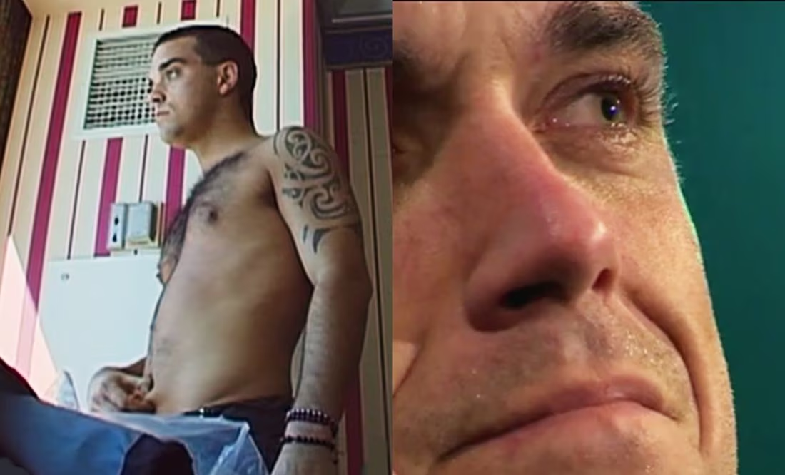 Robbie Williams habla de la anorexia que padecía: «Comía sólo un plátano al día»