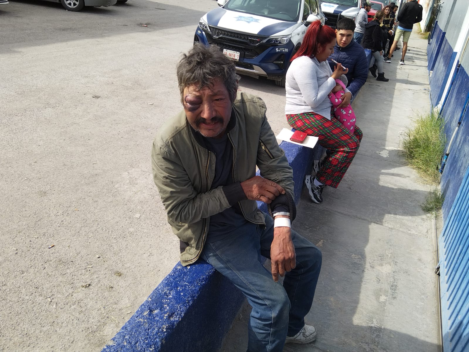 Casi queda tuerto por conducir ebrio