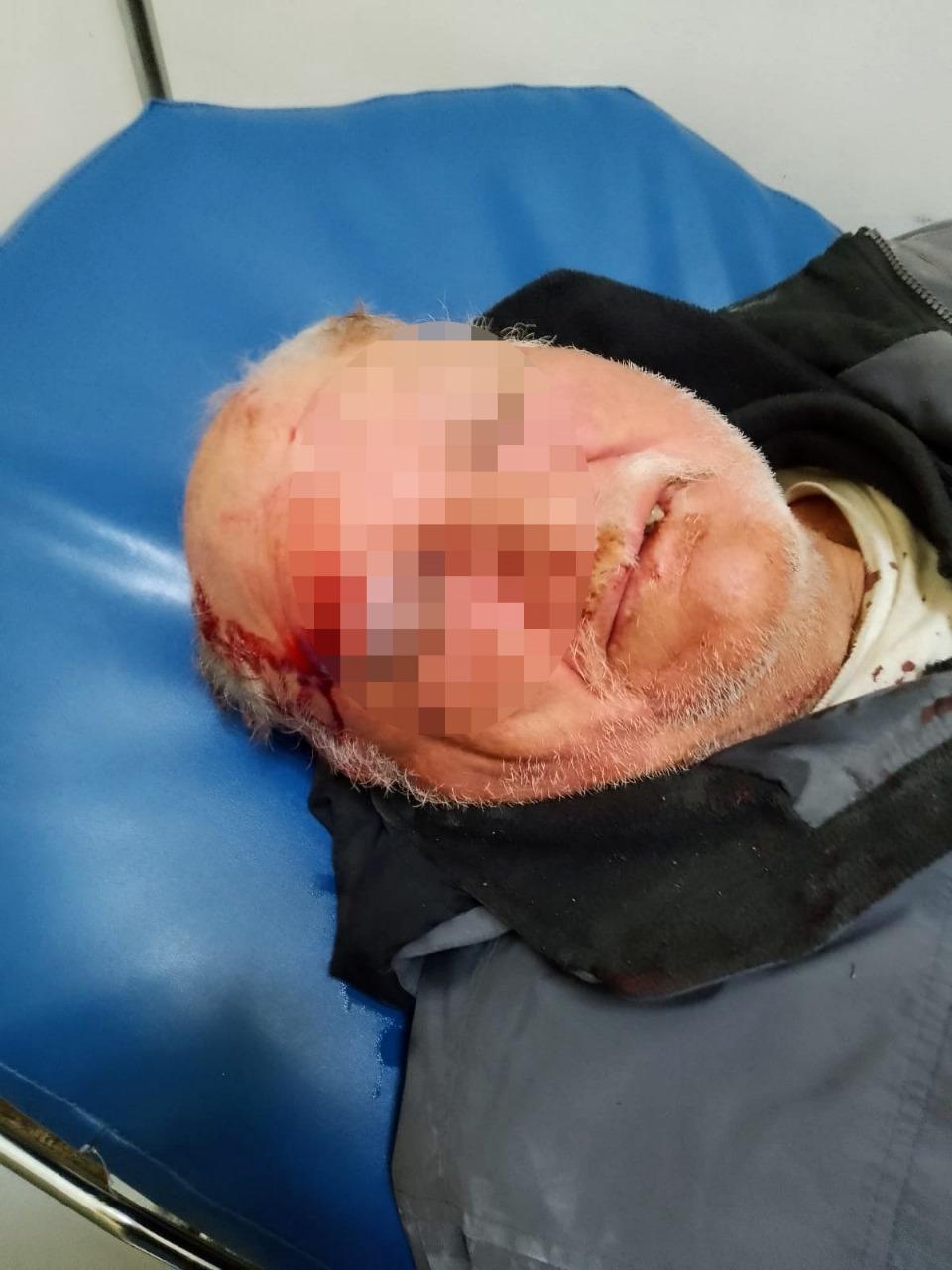 Víctima grave en Terapia y juez deja libre al agresor