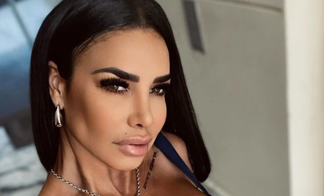 Lis Vega y la mala cirugía estética que le arruinó los labios