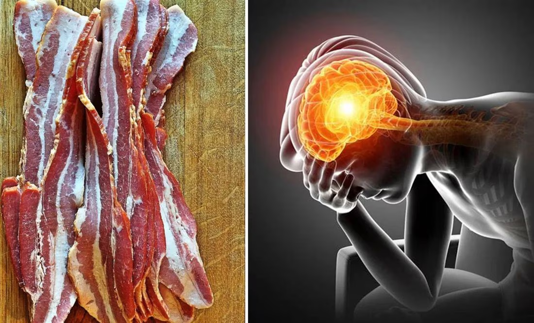 Hombre acude al hospital por migraña; le encuentran larvas en el cerebro tras comer tocino