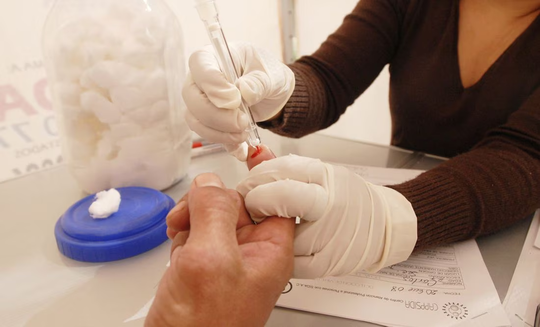 Científicos logran eliminar el VIH de las células