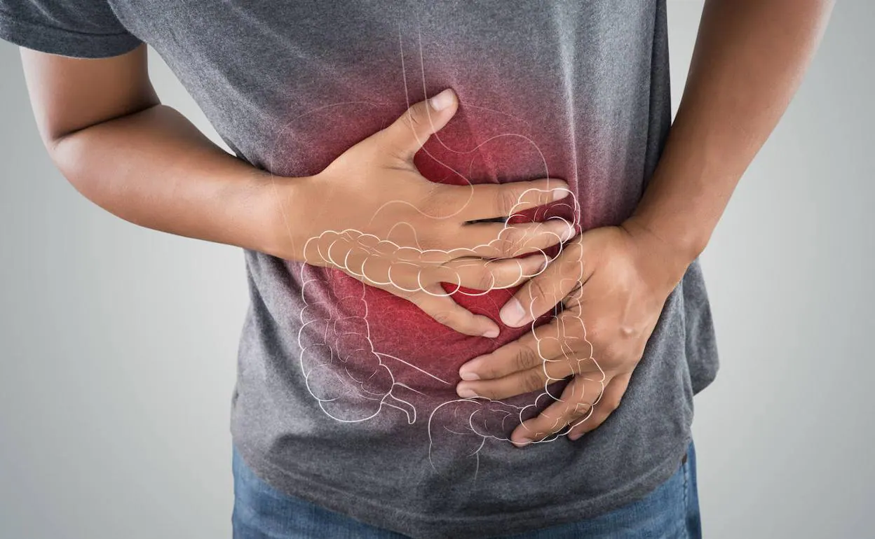Cáncer de colon: Especialista explica cómo detectarlo a tiempo