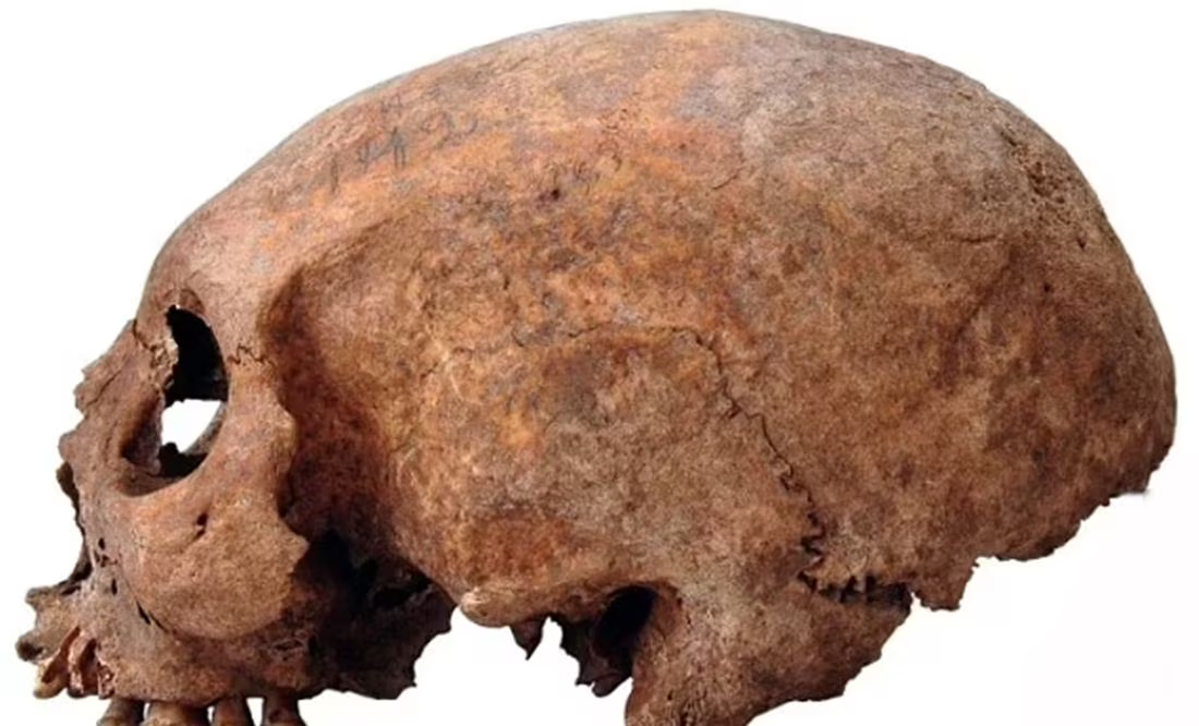 Estudio sugiere que los vikingos ya hacían cirugías plásticas: «alargaban cráneos»