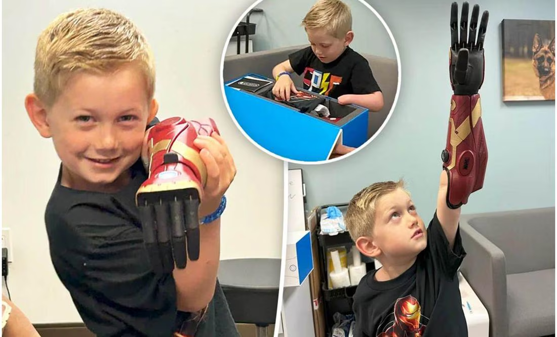 Al estilo Iron Man, niño de 5 años se convierte en el más joven del mundo en utilizar un brazo biónico