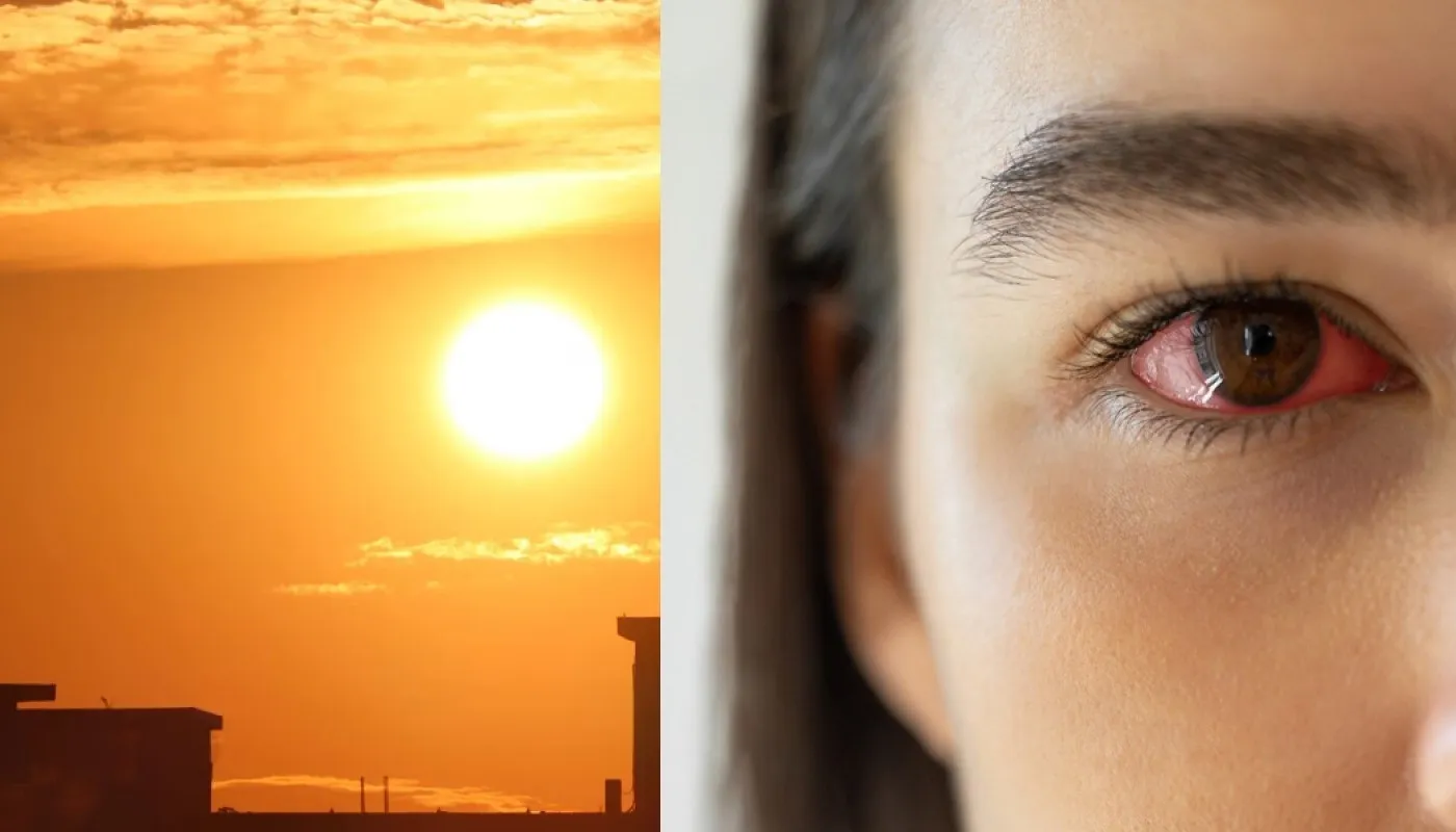 Olas de Calor en México provoca el Síndrome del Ojo Seco, averigua cómo se da