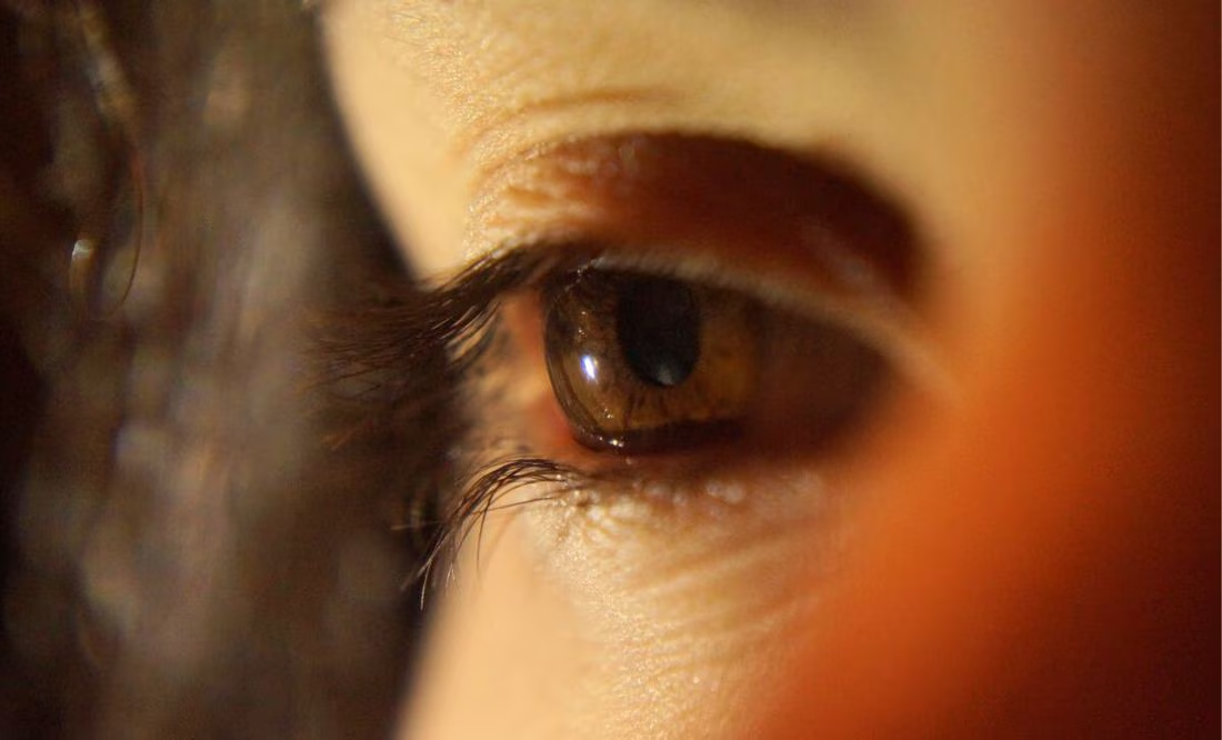 ¿Cómo detectar el glaucoma a tiempo?