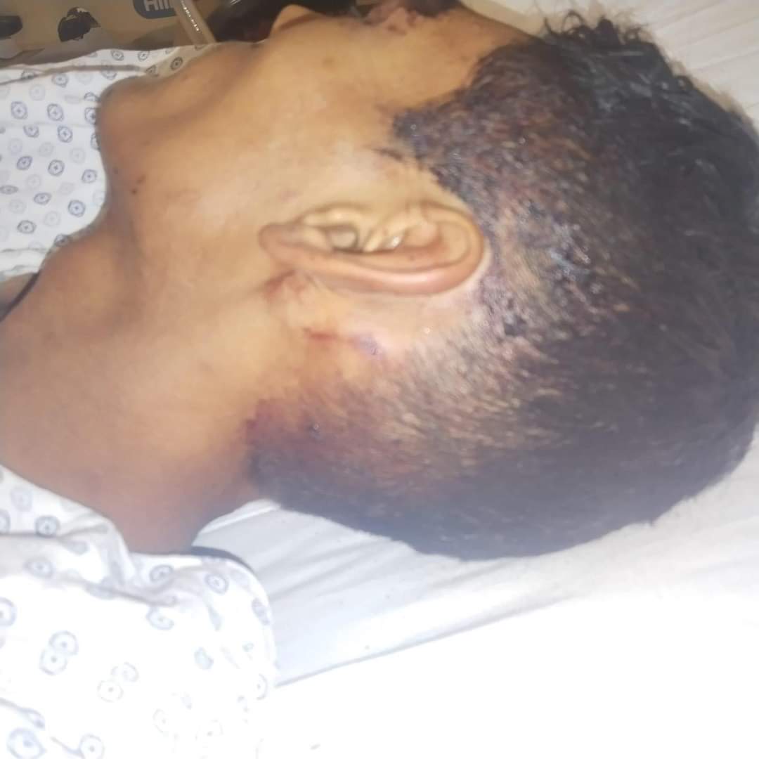 Grave joven tras brutal golpiza