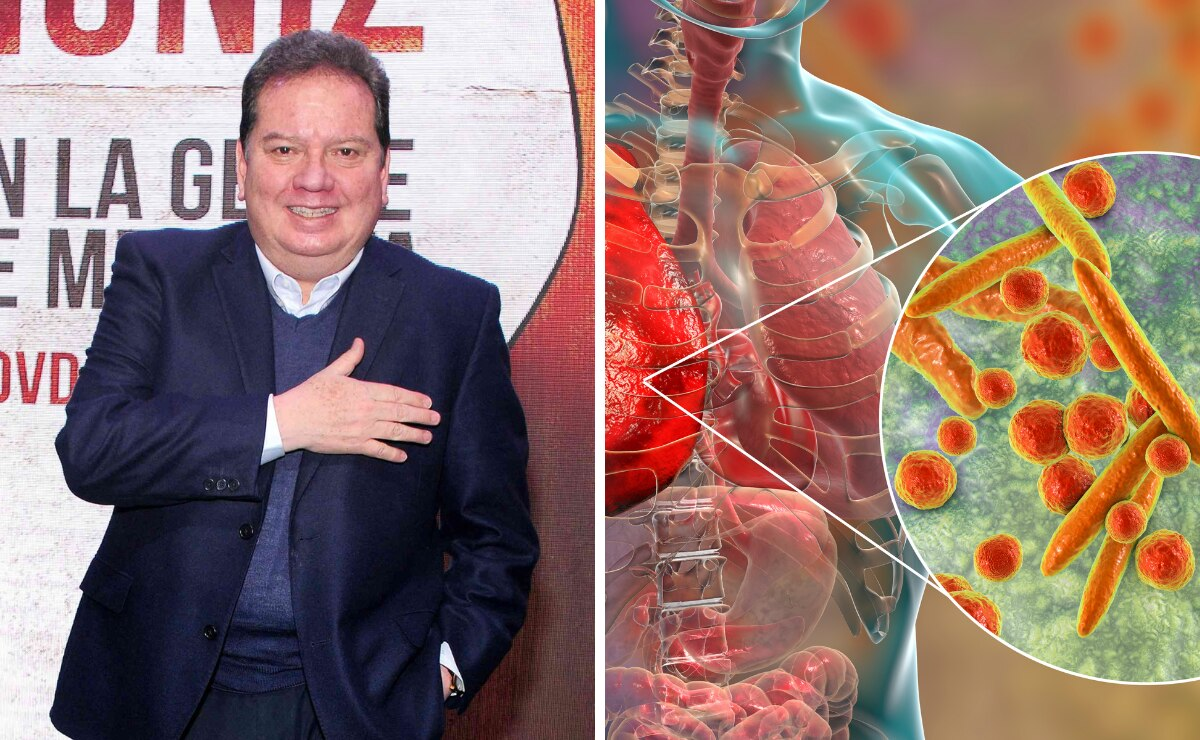 ¿Cuáles son los síntomas de la bronconeumonía, enfermedad que hospitalizó a Coque Muñiz?