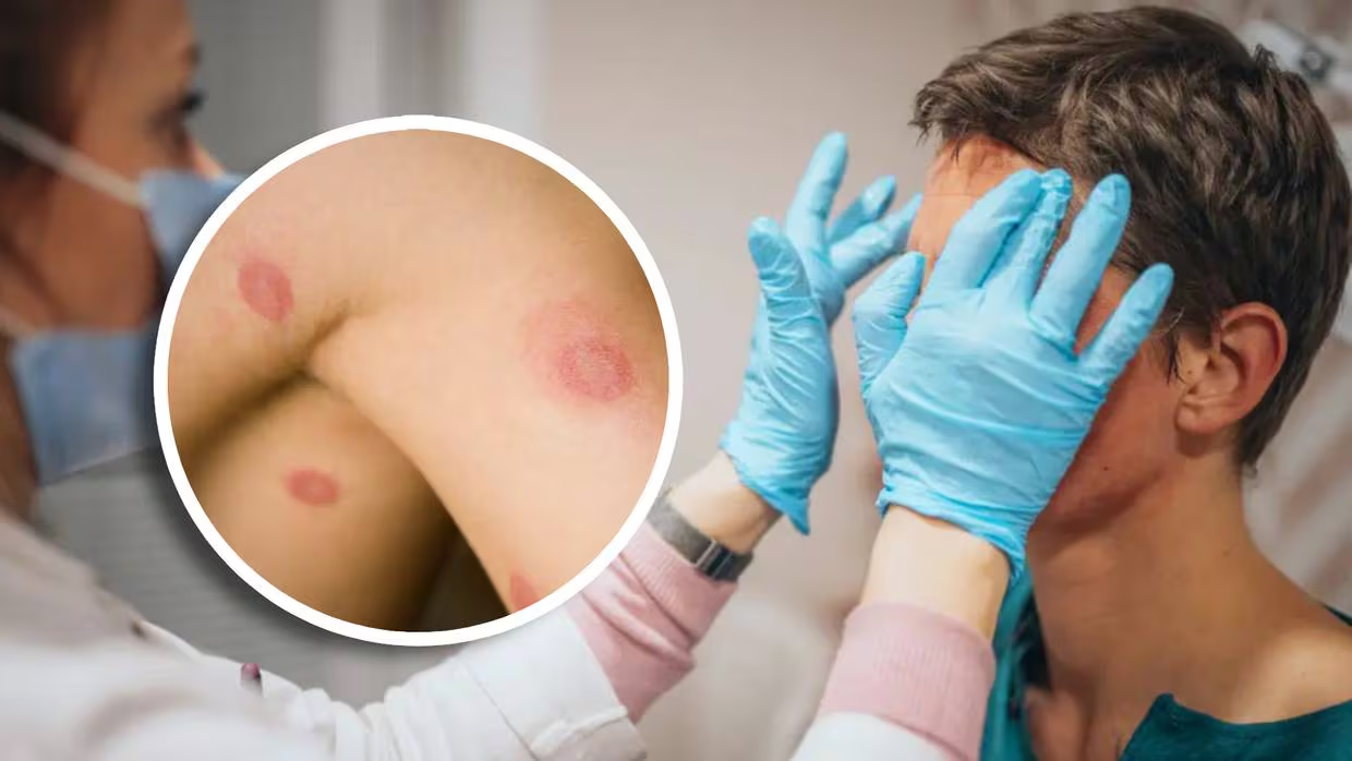 Nueva ETS llega a EU: Hongos altamente contagiosos