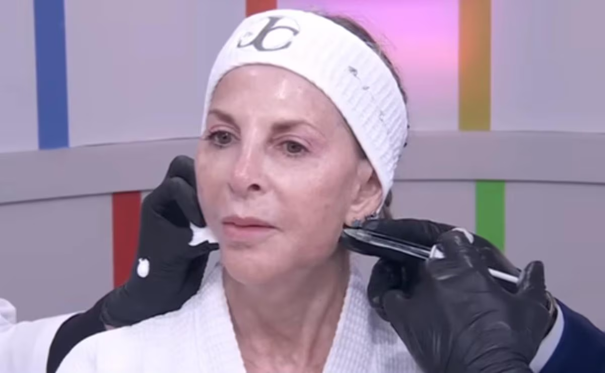 Shanik Berman se coloca 19 jeringas de ácido hialurónico previo a su ingreso a «LCDLF»