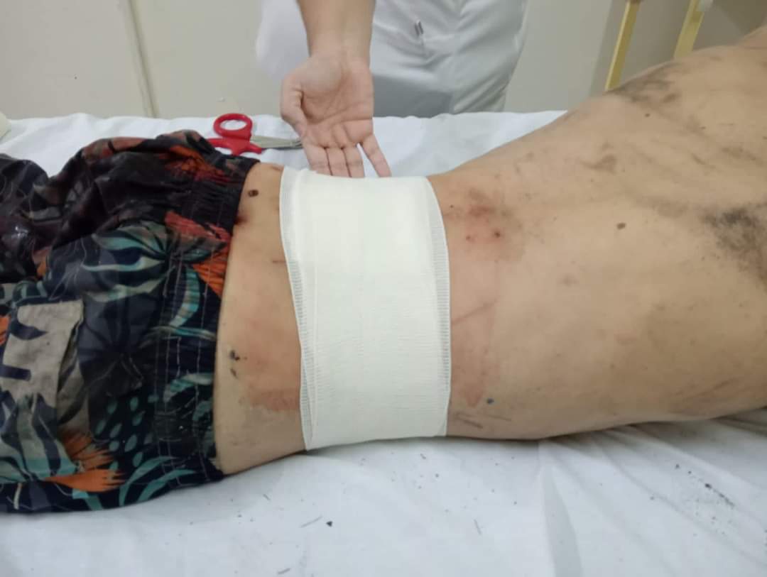 Hiere con vidrio mujer a pareja