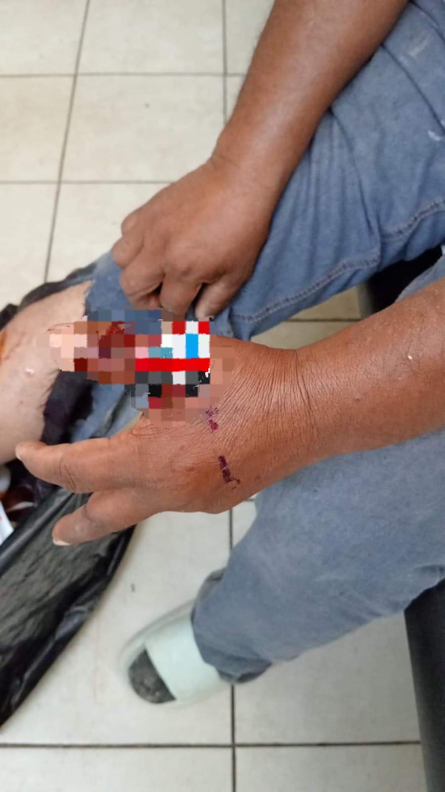 Agrede Pitbull a trabajador de Simas