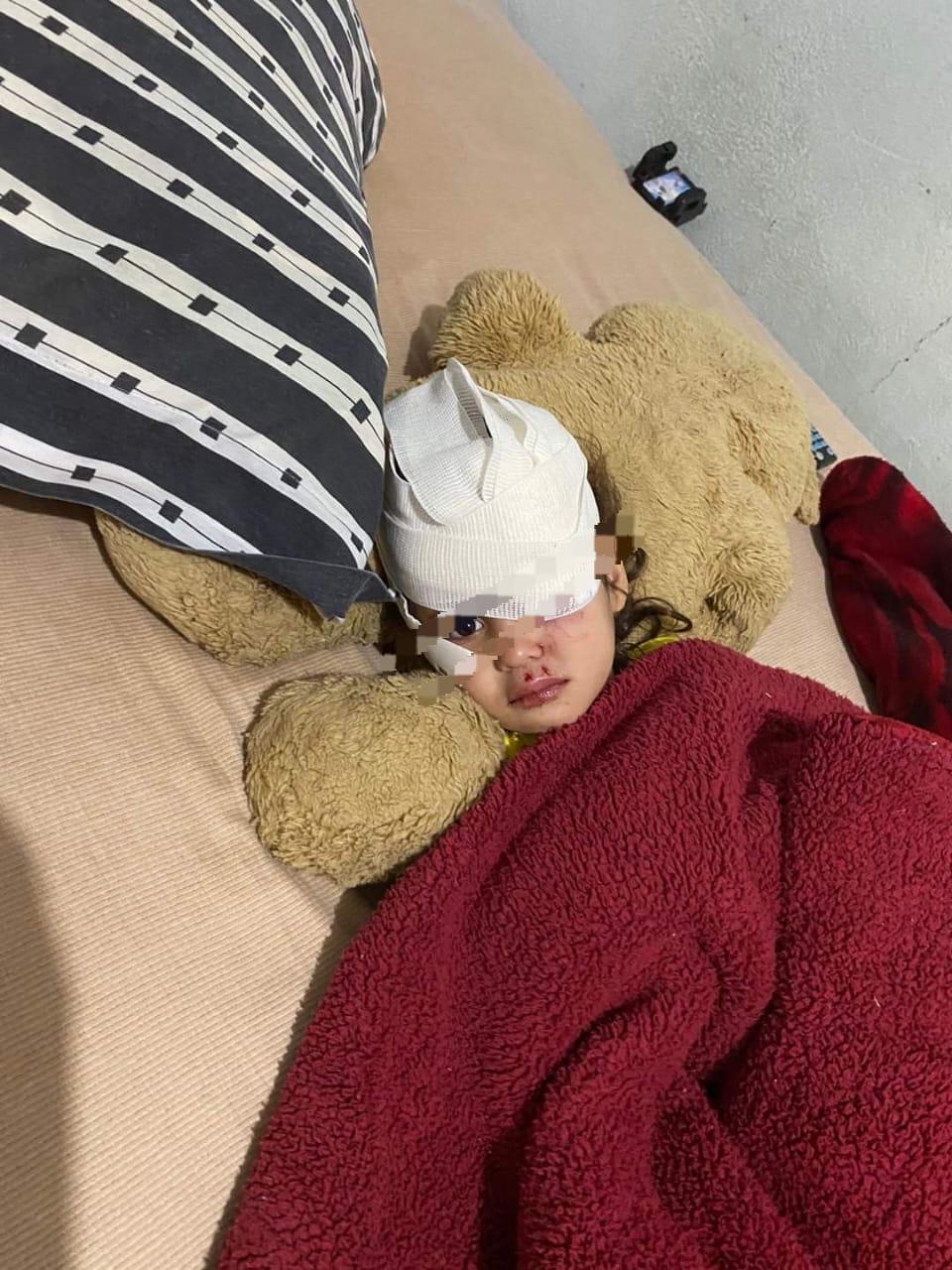 Ataca perro a niña de 3 años