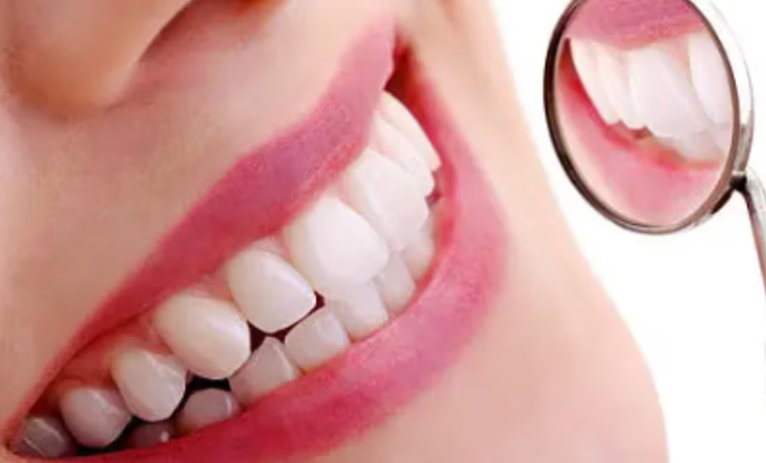 3 alimentos clave para reparar el esmalte dental; revierte los dientes amarillos