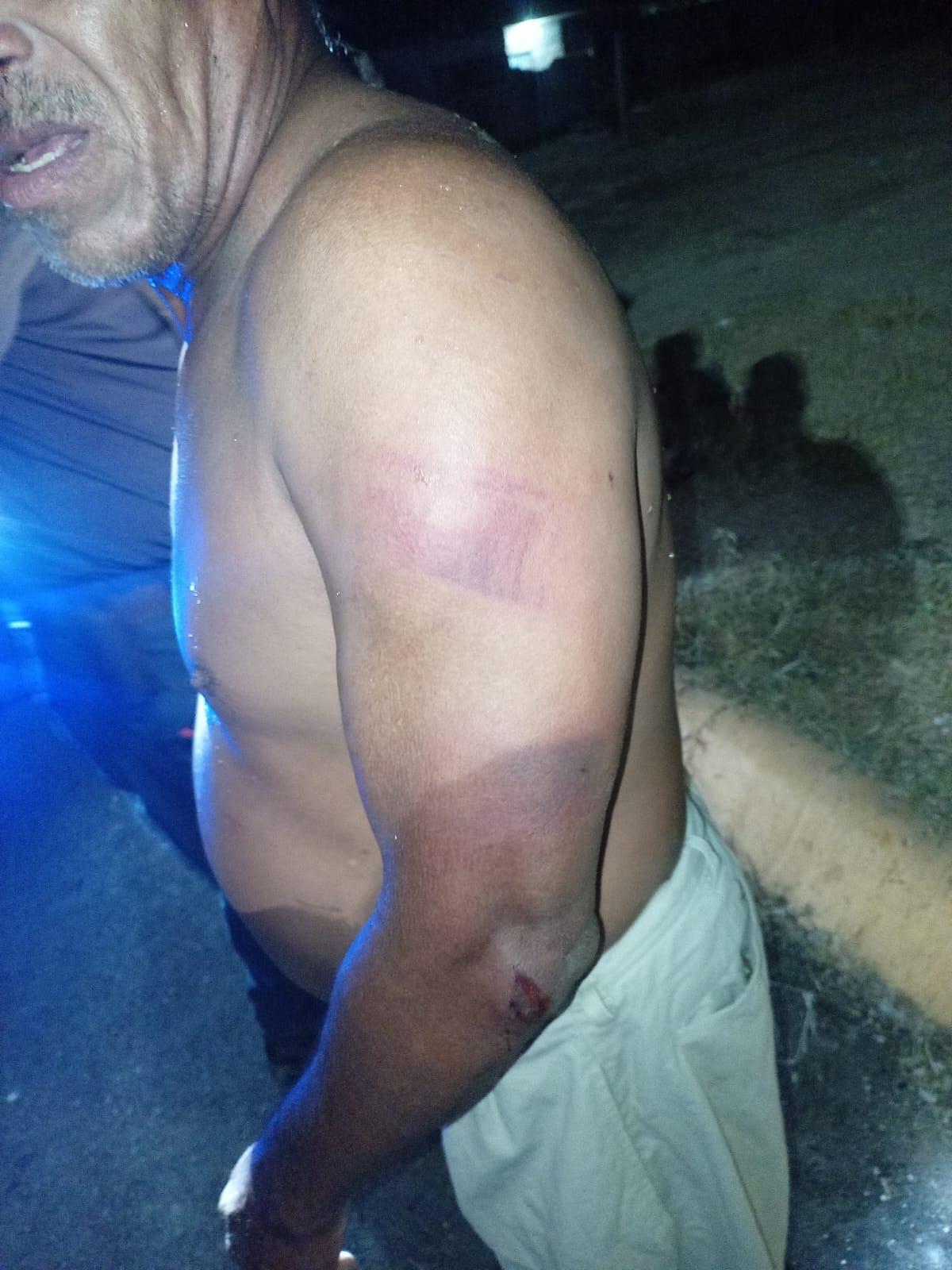 Fractura a su padre el hombro a golpes