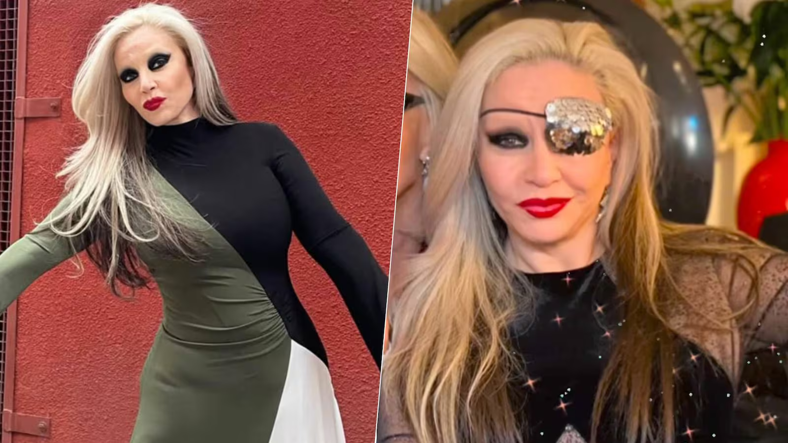 Alaska pierde la visión de un ojo: ¿Qué le pasó a la cantante?