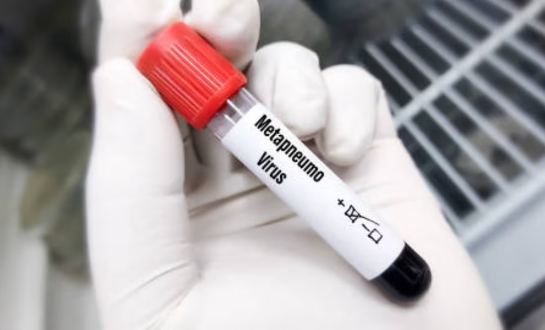 Autoridades de Nuevo León confirman dos casos de Metapneumovirus; descartan alerta de salud