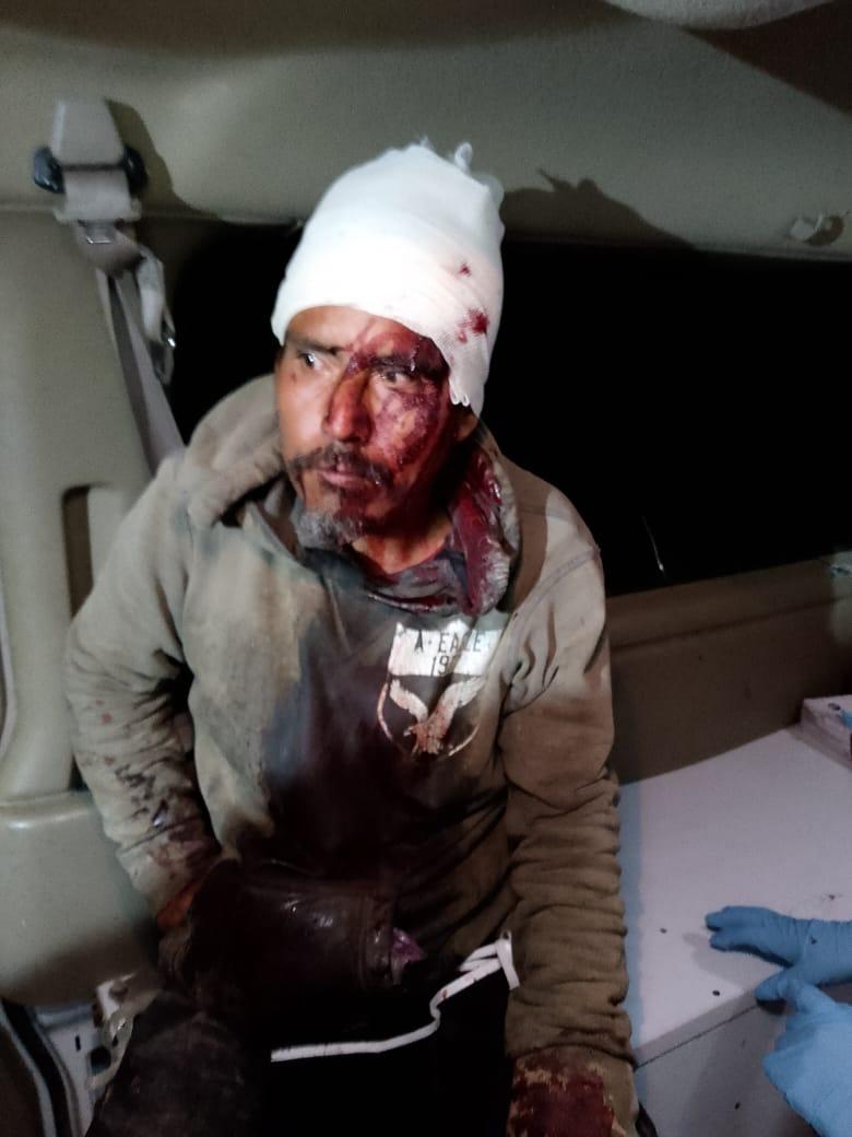 Golpean sin piedad a indigente en festejo