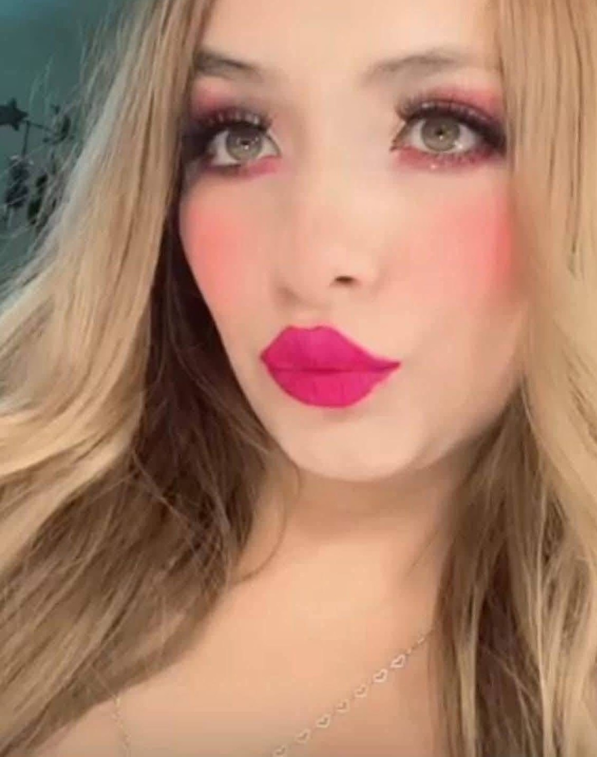 Muere saltillense en Mty durante cirugía estética