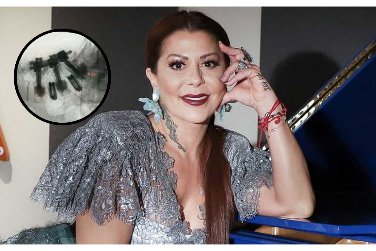 Alejandra Guzmán reaparece tras cirugía de columna: «este es el fin de tanto que he pasado en 13 años»