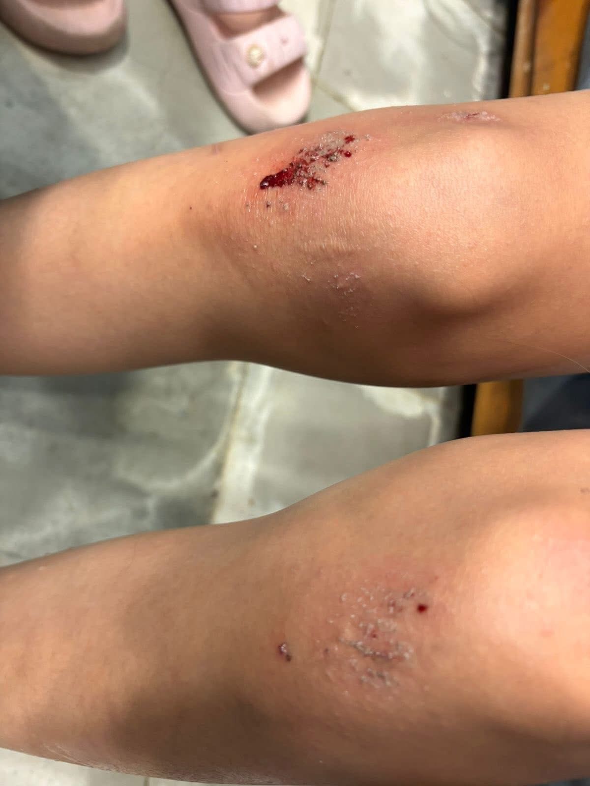 Atiende Servicios Educativos caso de bullying en primaria