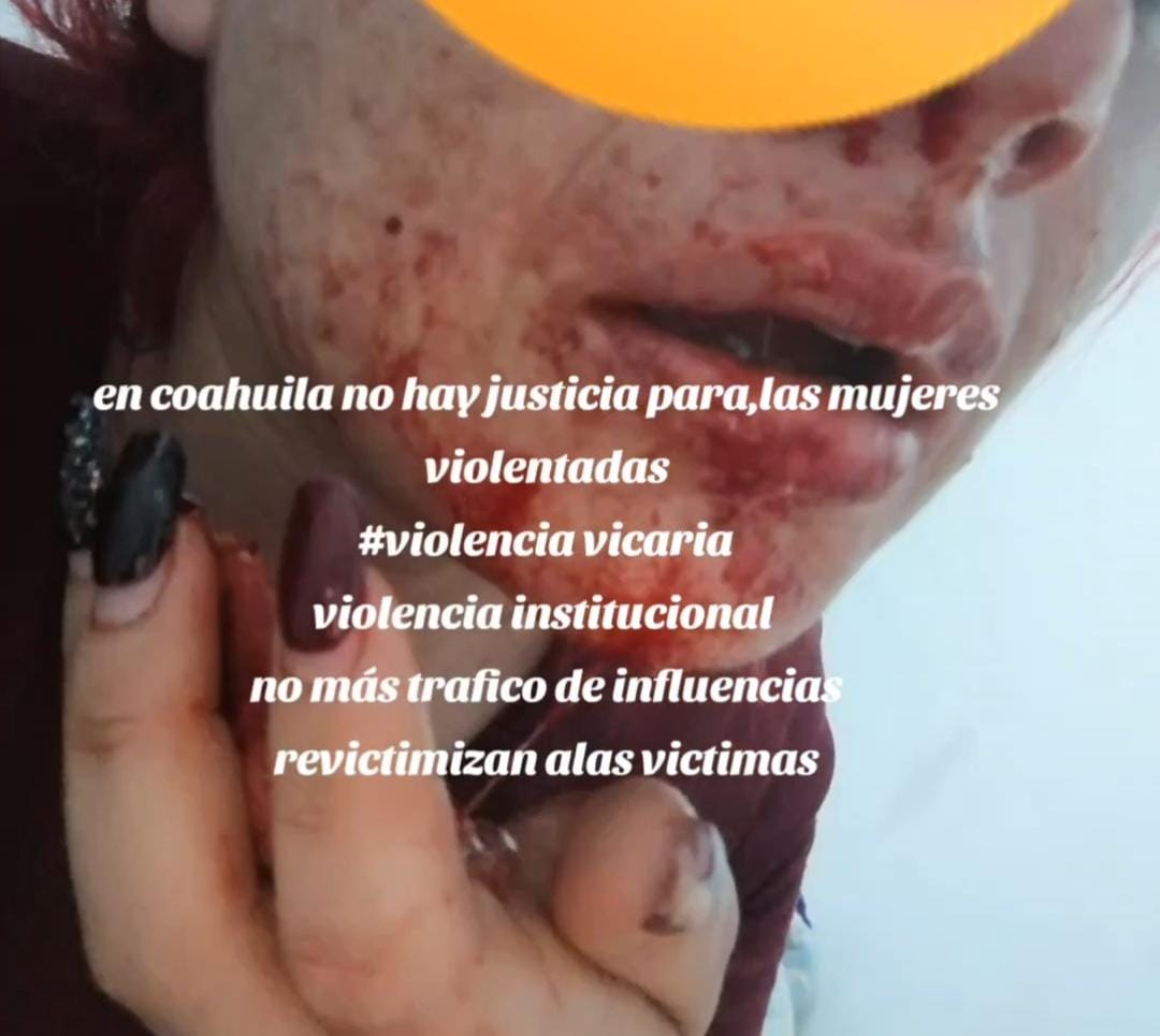 Enfrenta Yareli 5 años de litigio por violencia