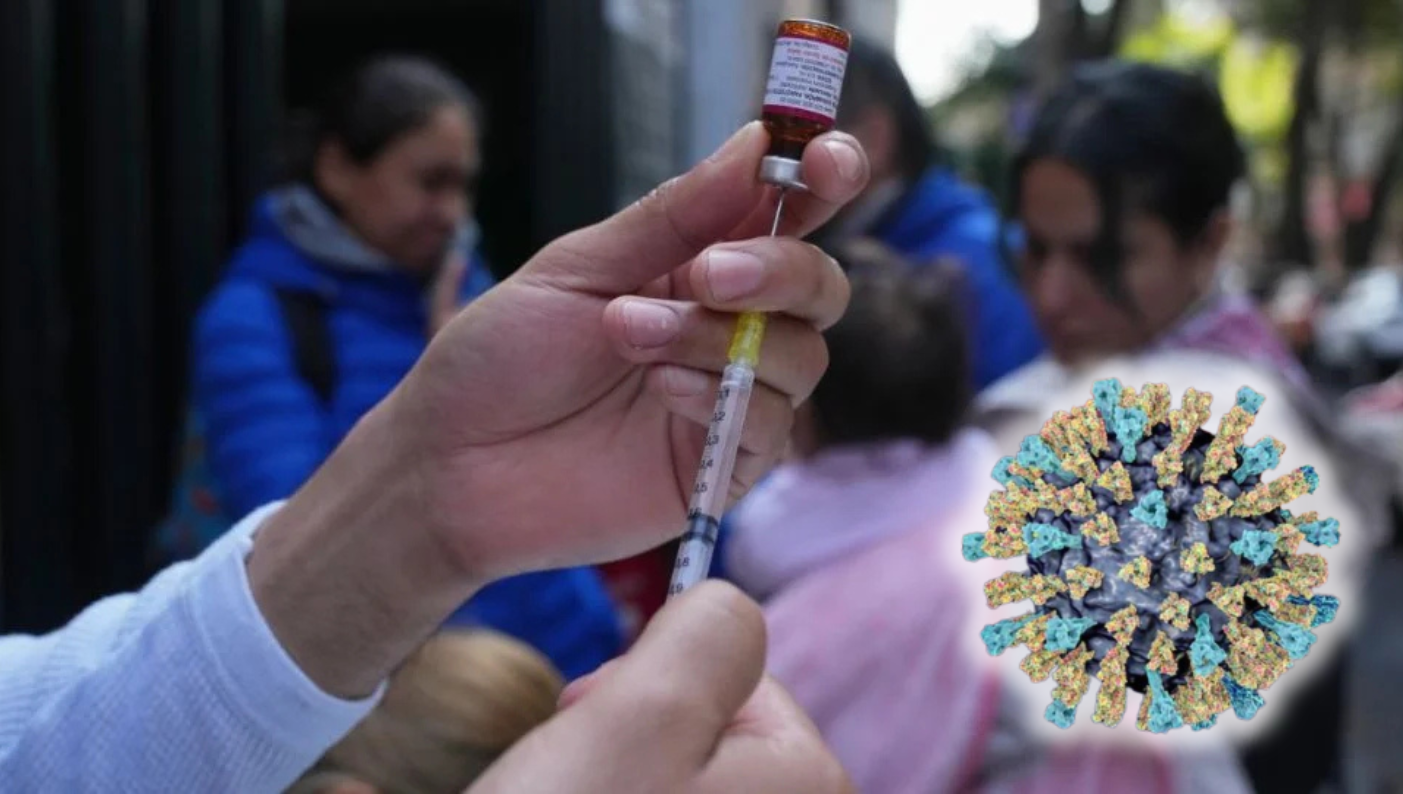 ¿Tienes sarampión?: cómo saber si tienes los síntomas y si necesitas vacunarte