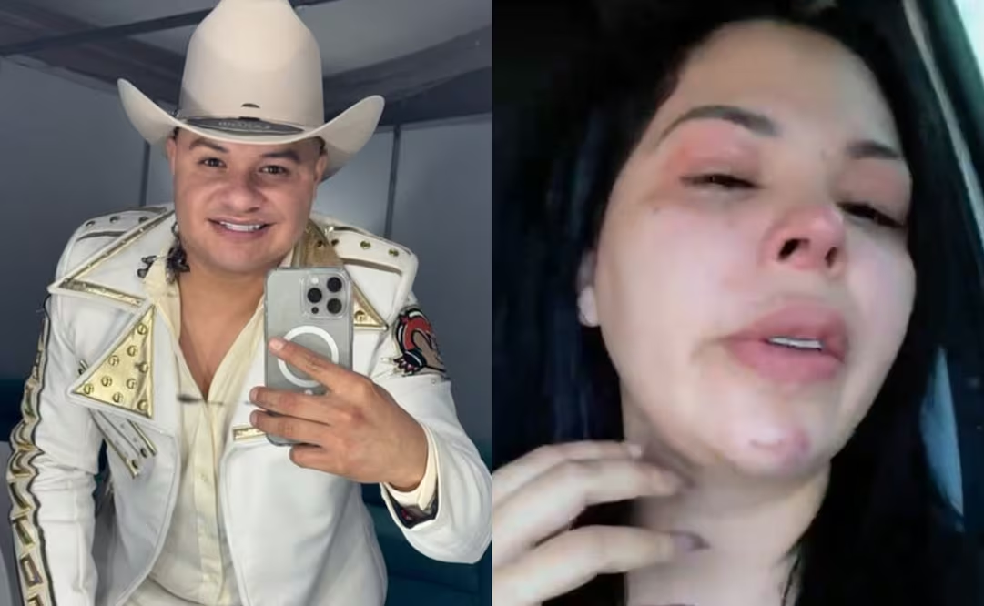 Vocalista de Los Recoditos es acusado de violenci4 doméstica