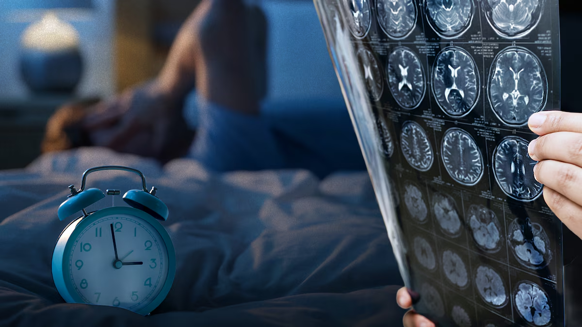 ¿Duermes bien? Enfermedades que podrías desarrollar por no tener una buena higiene del sueño