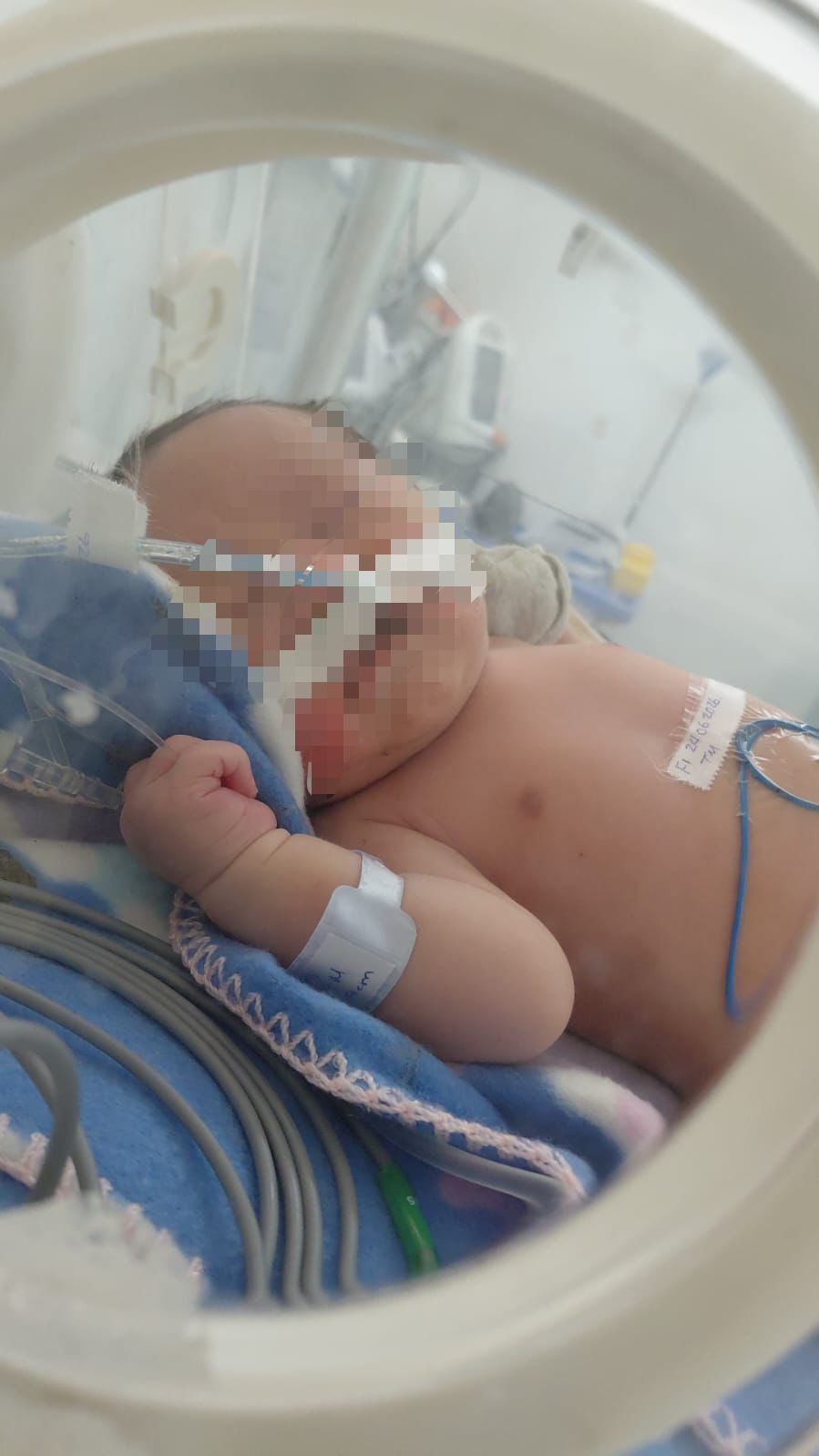 Pese a gravedad de bebé IMSS lo envía en vano a C. Acuña