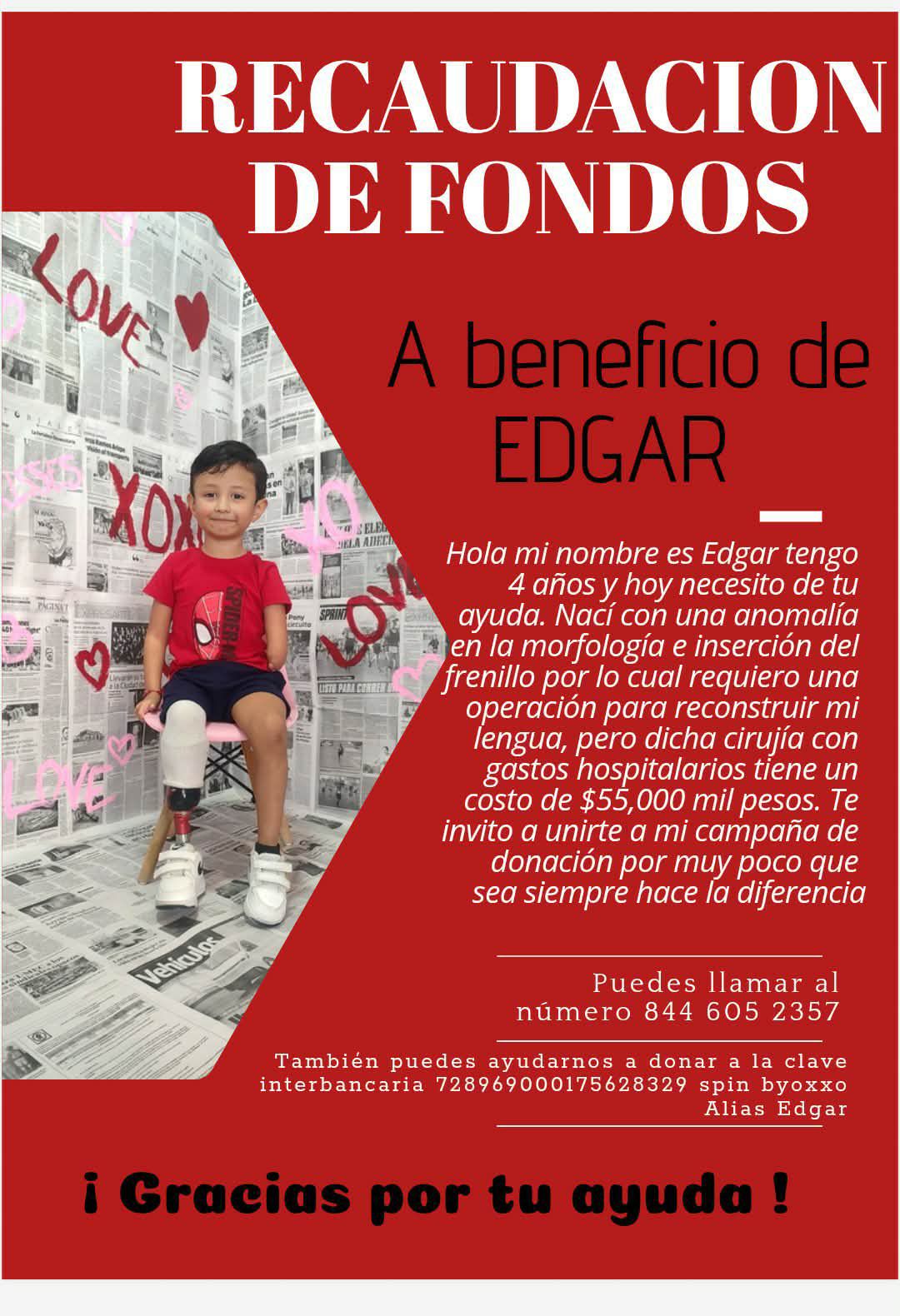 Pequeño de Ramos Arizpe necesita apoyo para cirugía