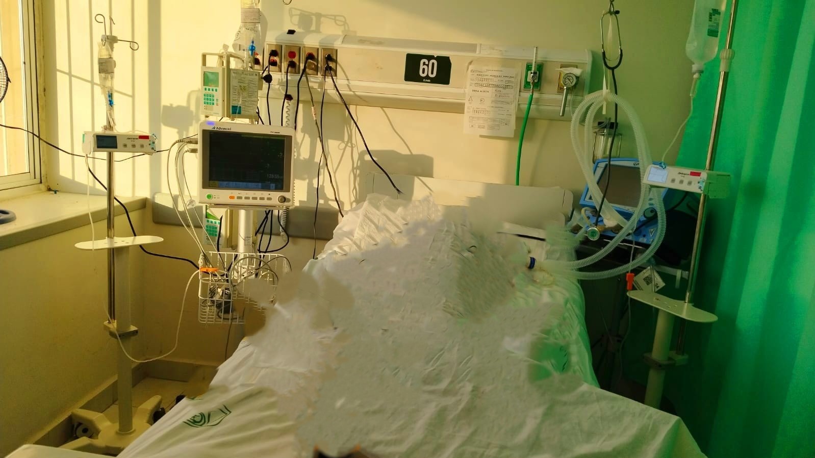 Ingresa al IMSS para operación de vesícula; fallece 18 días después