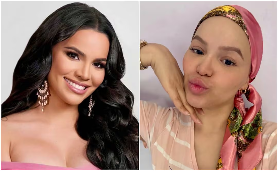 Miss Universe Puerto Rico lucha contra el cáncer de seno a sus 32 años: «El cuerpo duele, la energía desaparece»